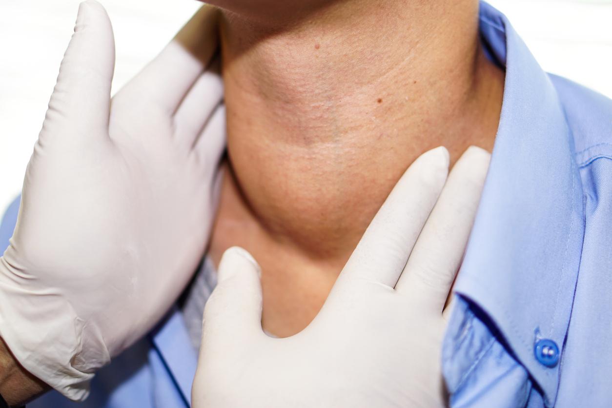 Asian lady woman patient have abnormal enlargement of thyroid gland Hyperthyroidism (overactive thyroid) at the throat : healthy strong medical concept
