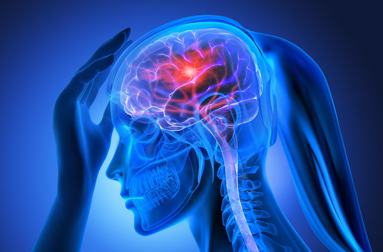 X ray Woman with strong headache symptom and brain stroke - black background - 3D illustration
